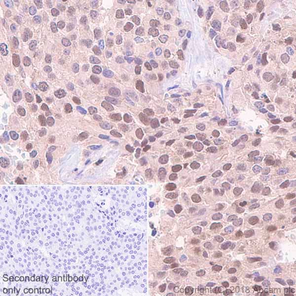 Anti-Visfatin antibody [EPR21984] - BSA and Azide free(AB240560)