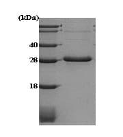 Recombinant Human Adiponectin protein(ab51294)