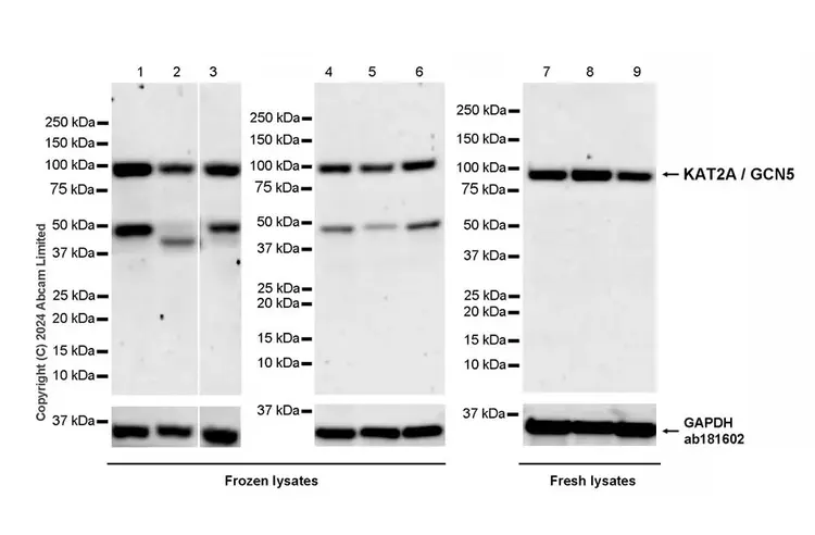 Anti-KAT2A / GCN5 antibody [EPR28321-83](AB321885)