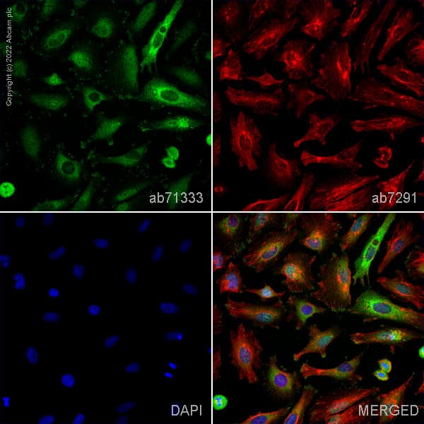 Anti-Talin 1 antibody(AB71333)