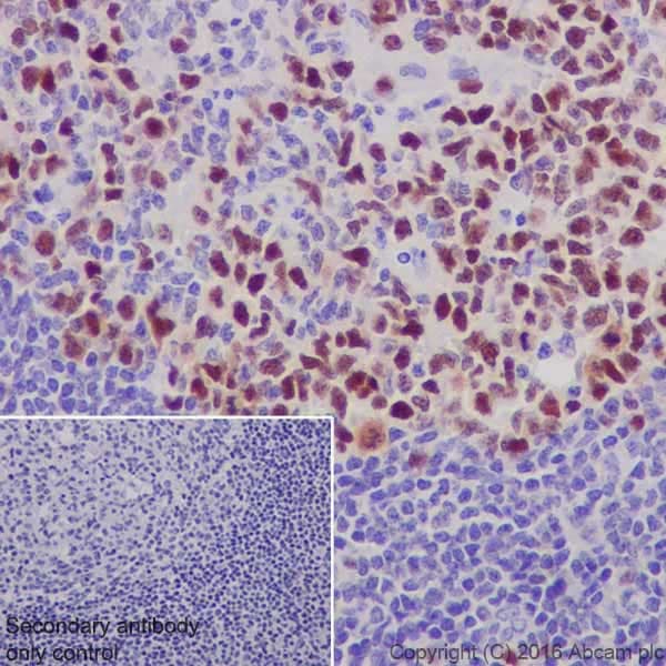 Uhrf1 Antibody Epr18803 11 Ab213223  Immunohistochemistry Formalin Pfa Fixed Paraffin Embedded Sections Img132737