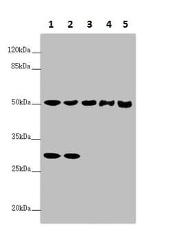 G5pr Antibody Ab230347  Western Blot Img6038