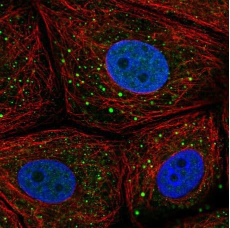 Msmp Antibody Ab185471  Immunocytochemistry Immunofluorescence Img84315