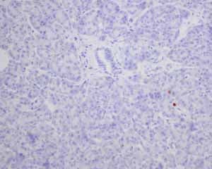 Anti-S100P antibody [EPR6142](AB124743)