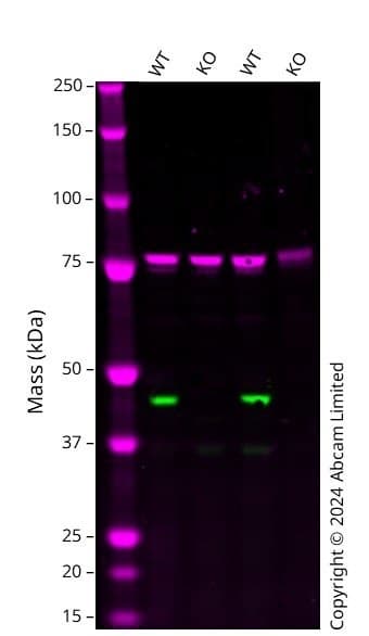 Anti-Calnexin antibody [CANX/1543](AB238078)