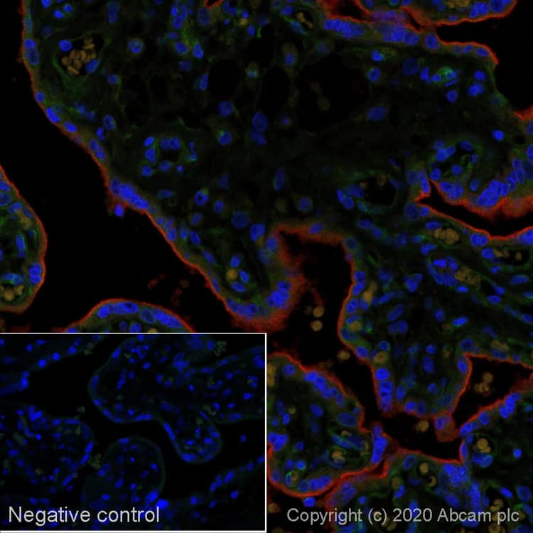 Anti-PD-L1 antibody [SP142] - BSA and Azide free(ab236238)
