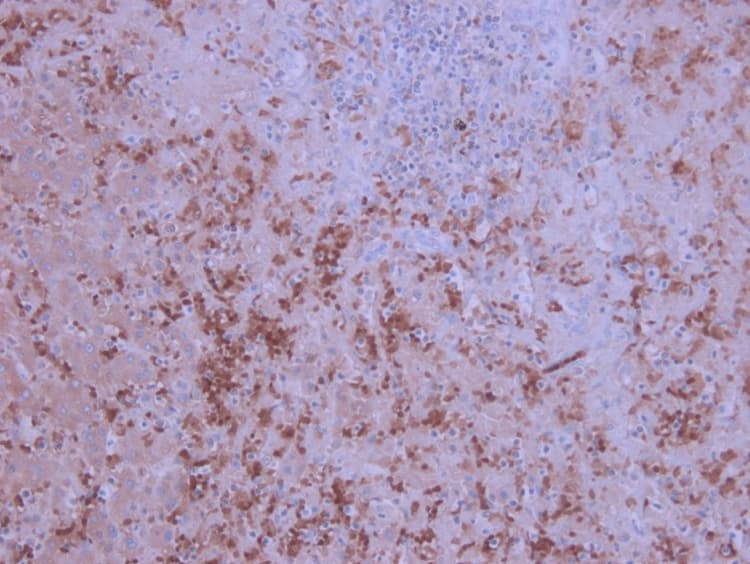 Anti-IL-6 antibody [1.2-2B11-2G10](AB9324)