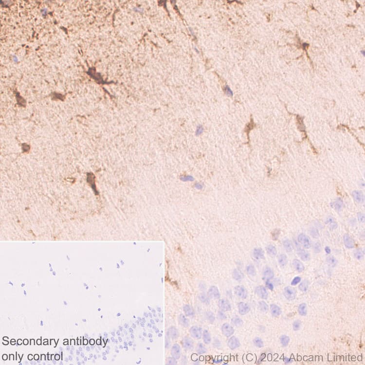 Anti-PADI2 / PAD2 antibody [EPR26940-85](ab322197)