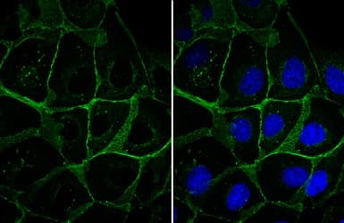 Anti-beta Catenin antibody - ChIP Grade(AB227499)