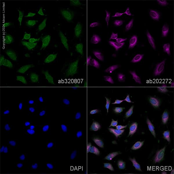 Alexa Fluor 594 Alpha Tubulin Antibody Ep1332y Microtubule Marker Ab202272  Immunocytochemistry Immunofluorescence Img434827