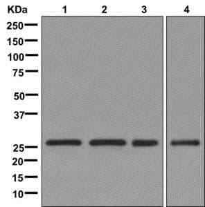 Ethe1 Antibody Epr11697 Bsa And Azide Free Ab249805  Western Blot Img116337