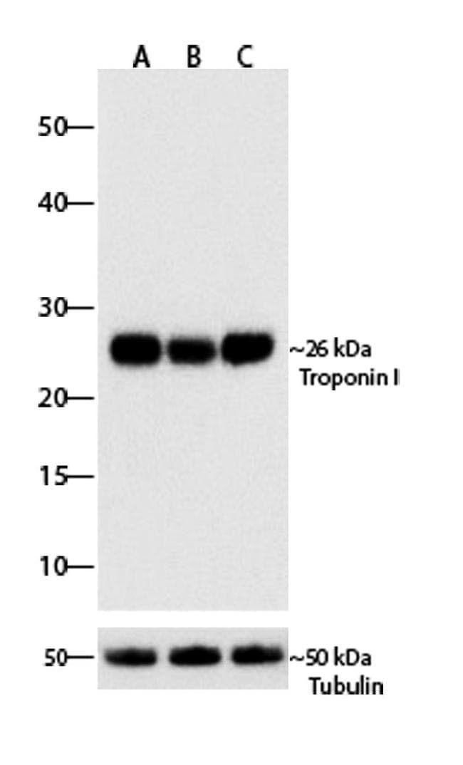 Anti-Cardiac Troponin I Antibody [RP23040093](AB313411)