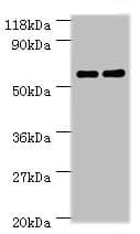 Carboxylesterase 1c Antibody Ab193485  Western Blot Img86517