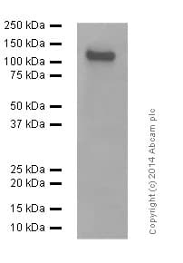 Anti-NMDAR1 antibody [EPR2481(2)](AB109182)