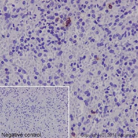 Anti-Neutrophil Elastase antibody [EPR7479](AB131260)