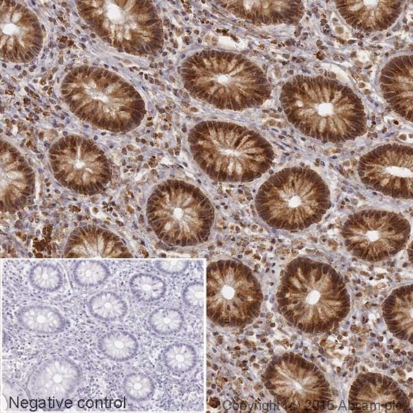 HRP Anti-YB1 antibody [EP2708Y](AB204014)