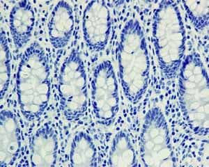 Snap25 Antibody Ep3274 Ab108990  Immunohistochemistry Formalin Pfa Fixed Paraffin Embedded Sections Img98547