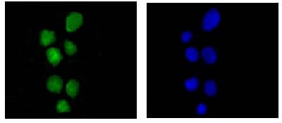 Hnrnp U P120 Antibody Epr122782b Bsa And Azide Free Ab250283  Immunocytochemistry Immunofluorescence Img71106