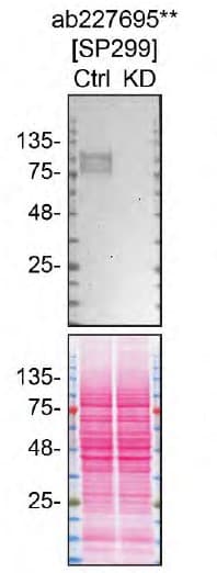 Gpnmb Antibody Sp299 Bsa And Azide Free Ab272016  Western Blot Img439666