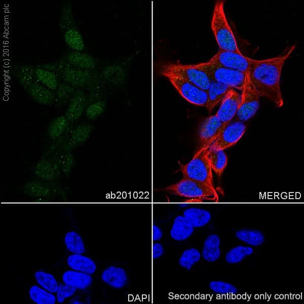 Anti-ATM antibody [EPR20100] - ChIP Grade(AB201022)