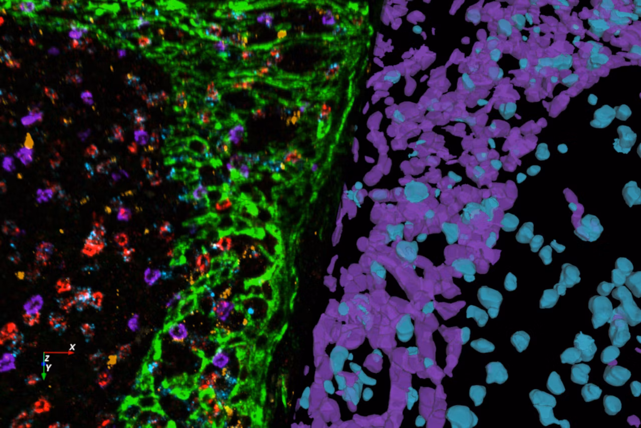 Multiplexed Human Tonsil Tissue Labeled With A Panel Of 8 OPAL Dyes And DAPI Kid21768072