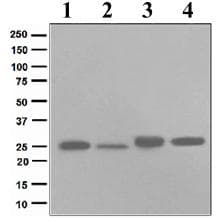 Anti-HPRT antibody [EPR5299](AB109021)