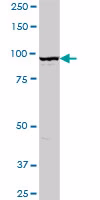 Golgin 97 Antibody Ab169287 Western Blot Img162396