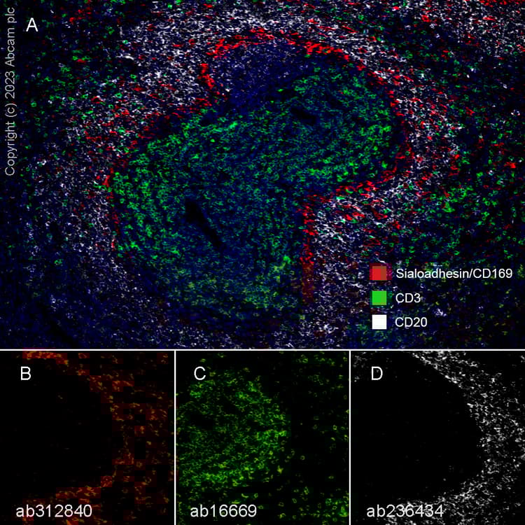 Anti-CD20 antibody [SP32](ab64088)
