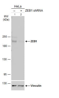 Anti-ZEB1 antibody(AB155249)