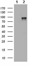 Anti-HIF-2-alpha antibody [OTI2G5](AB157249)