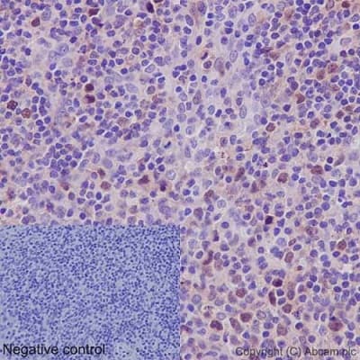 Anti-Cdk2 antibody [E304](AB32147)