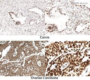 Anti-CDKN2A/p16INK4a antibody [2D9A12](AB54210)