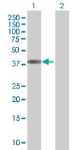 Ab94133  Western Blot Img149241
