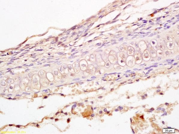 Anti-LRP5 + LRP6 antibody(AB217700)