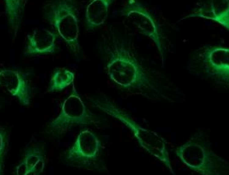 Anti-FGFR2 antibody(AB235277)