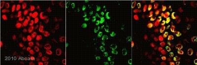 Anti-CDKN2A/p16INK4a antibody [2D9A12](AB54210)