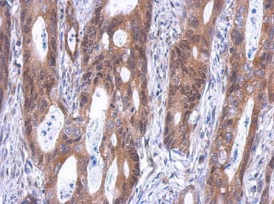 Sld5 Antibody Ab101346  Immunohistochemistry Formalin Pfa Fixed Paraffin Embedded Sections Img87406