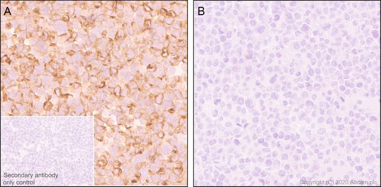 Ccl3 Mip 1 Alpha Ccl3l1 Antibody Epr23751 54 Ab259372  Immunohistochemistry Formalin Pfa Fixed Paraffin Embedded Sections Img109161