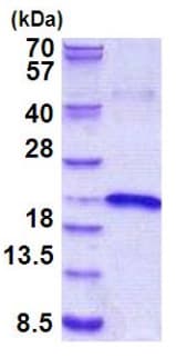 Recombinant Human IL-17B protein(AB156976)