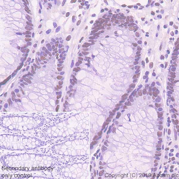 Rpa32 Rpa2 Antibody Epr22950 81 Ab240637  Immunohistochemistry Formalin Pfa Fixed Paraffin Embedded Sections Img58836