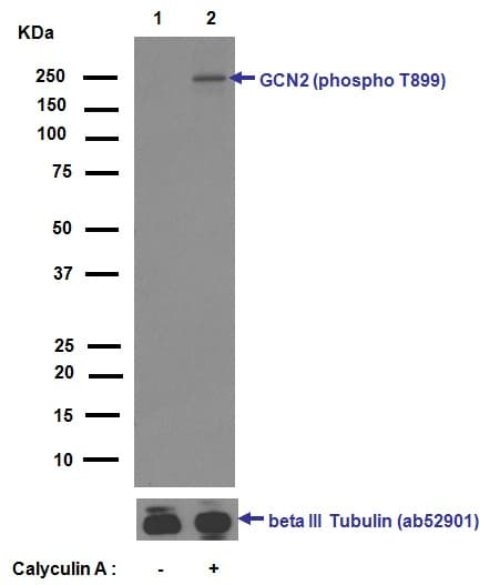 Anti-GCN2 (phospho T899) antibody [EPR2320Y](ab75836)