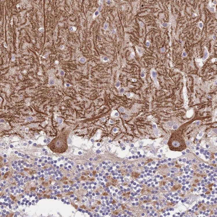 Ddhd1 Antibody Ab151078  Immunohistochemistry Formalin Pfa Fixed Paraffin Embedded Sections Img118588