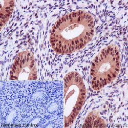 Hsp70 Antibody Epr16893 Ab194360  Immunohistochemistry Formalin Pfa Fixed Paraffin Embedded Sections Img138821