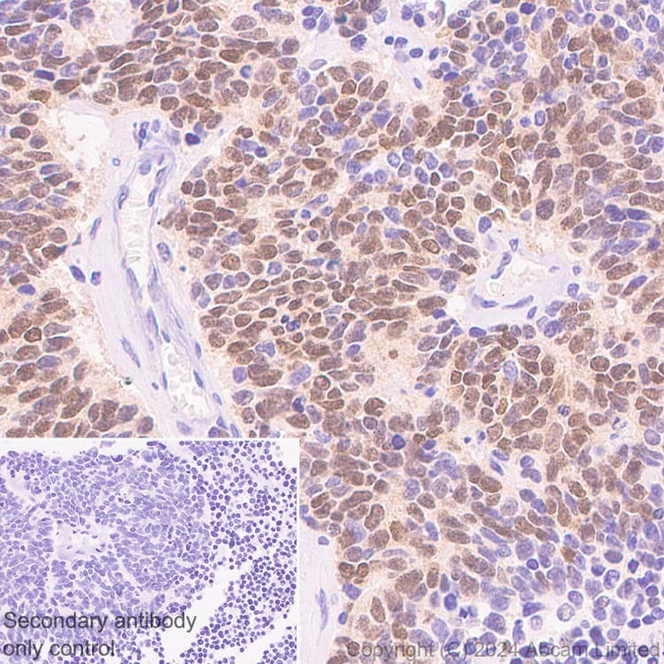 Anti-MASH1/Achaete-scute homolog 1 antibody [EPR19840](AB211327)