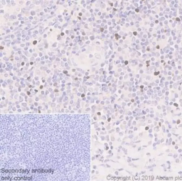 Anti-FOXP3 antibody [236A/E7](AB20034)