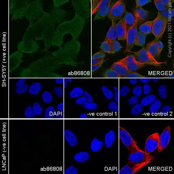 Goat Anti-Rabbit IgG H&L (Alexa Fluor® 594)(AB150080)
