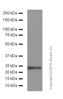 Anti-SOD2/MnSOD (acetyl K68) antibody [EPVANR2](AB137037)