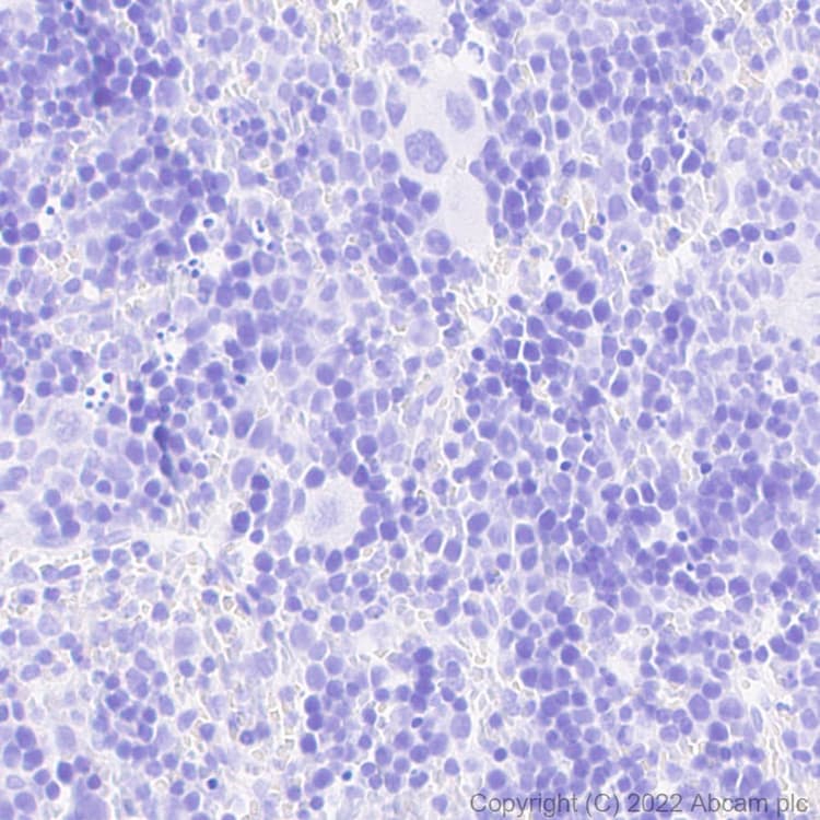 Anti-GFP antibody [EPR14104] - Chicken IgY (Chimeric)(AB300643)