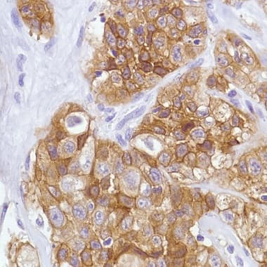 Anti-Met (c-Met) antibody [SP44] - C-terminal(AB227637)