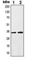 Anti-HOXA1 antibody(AB230513)